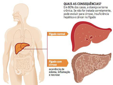 Quais as consequências?