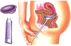 Diafragma e Espermicida