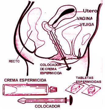 Como Aplicar o Espermicida